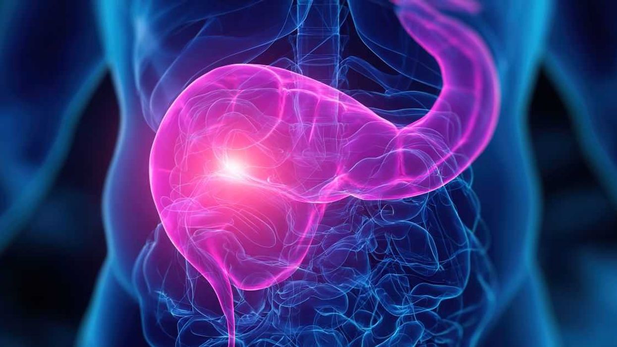 Nueva inmunoterapia para cáncer gástrico reduce un 29% el riesgo de progresión, recaída o muerte