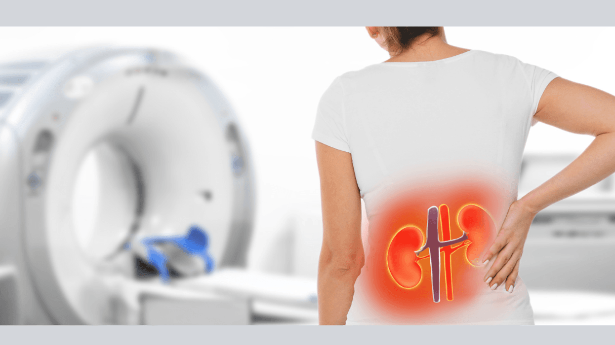 Estudio busca participantes en Guanacaste para investigar enfermedad renal que afecta a personas jóvenes