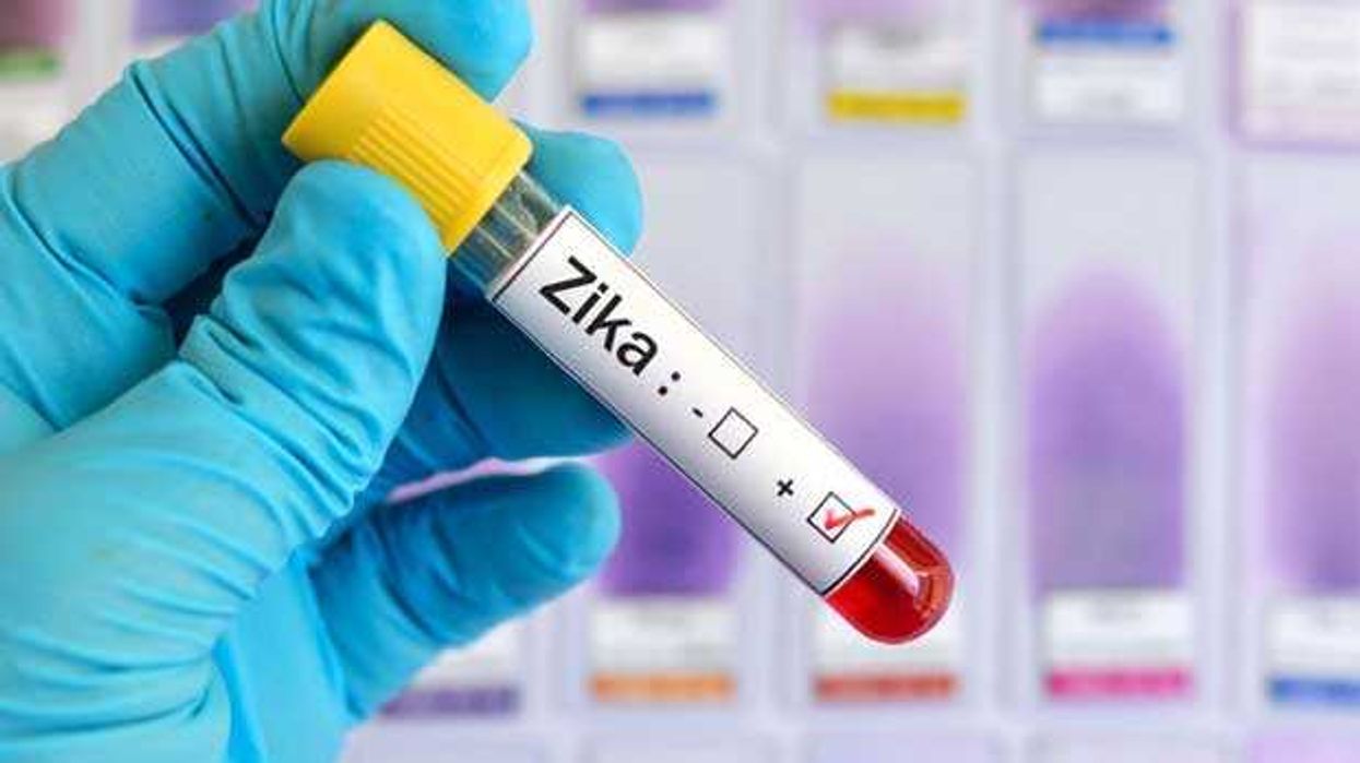 Salud reporta 131 nuevos casos de zika