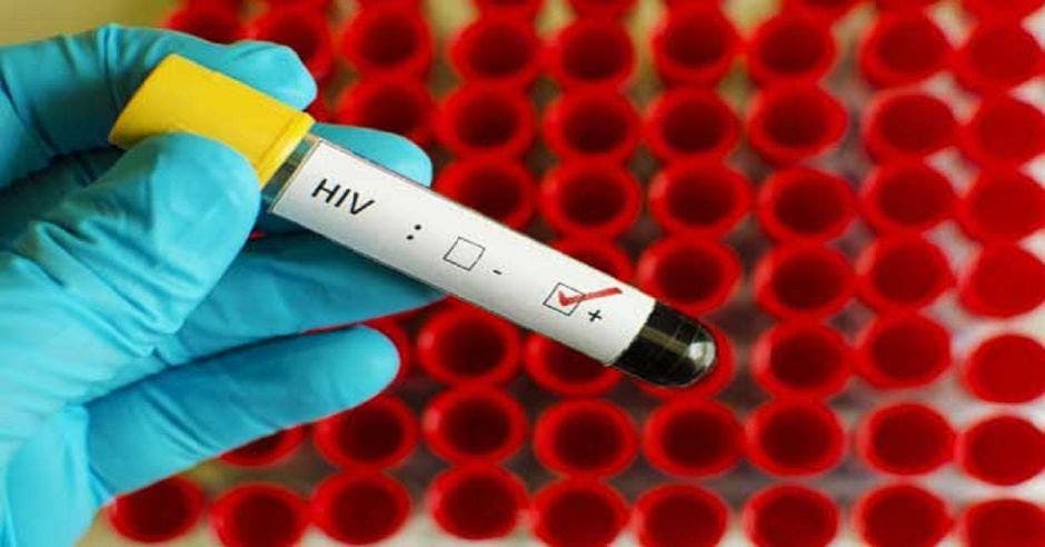 Una prueba de sangre con un check en la palabra sida