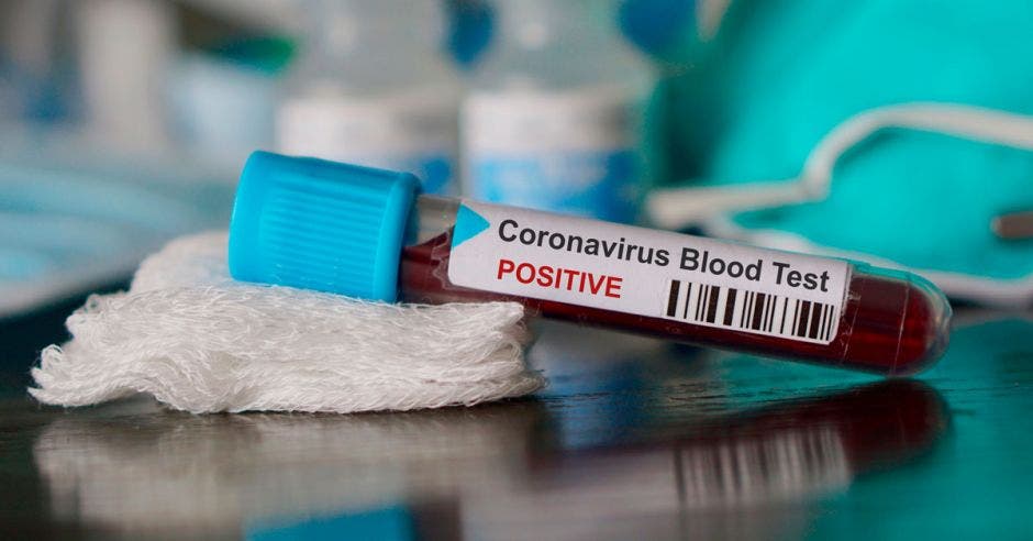 Una prueba de sangre con la palabra coronavirus