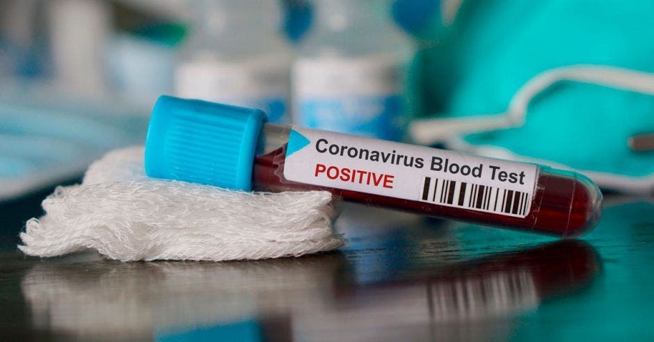 Una prueba positiva de coronavirus
