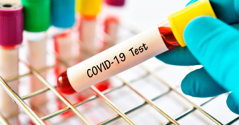 Coronavirus test