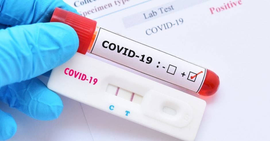 Una prueba de Coronavirus