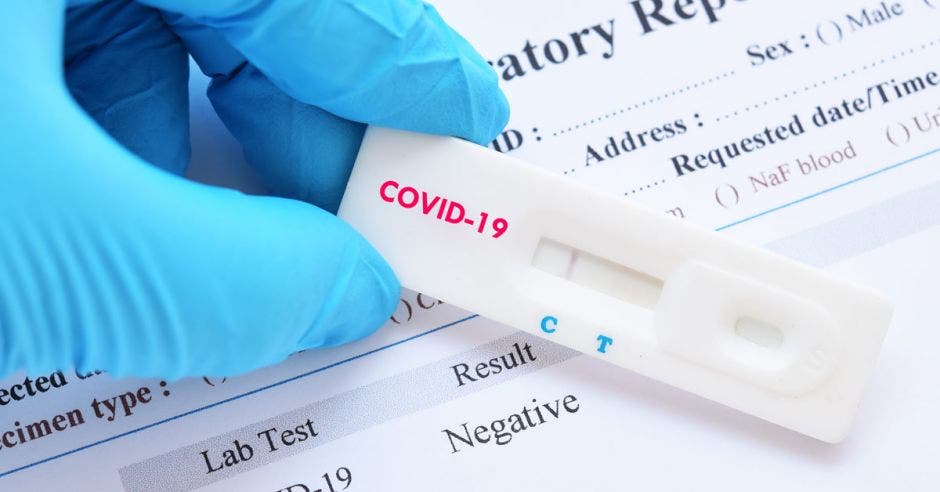 Una prueba de coronavirus