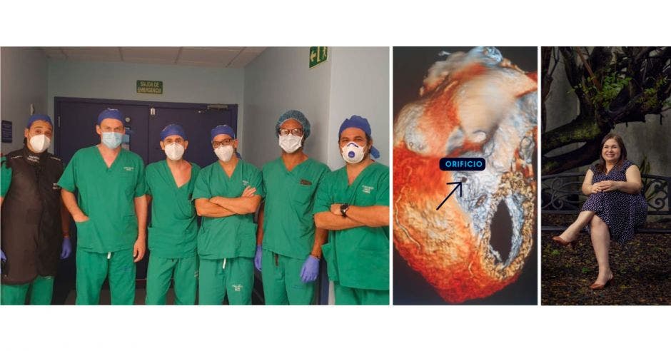 Especialistas que participaron en la primera cirugía cerraron con cateterismo un difícil orificio congénito del corazón; también la imagen de la operación y la paciente