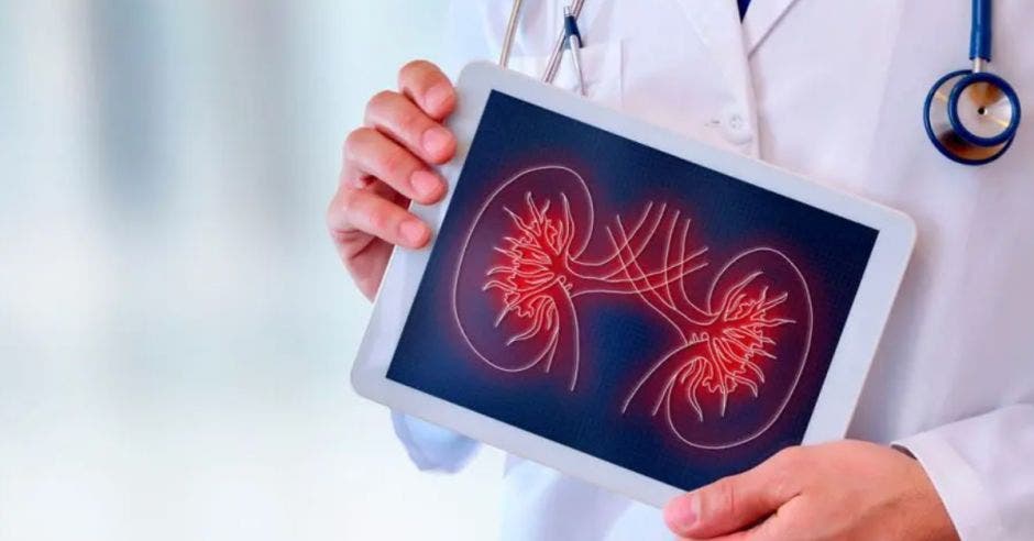 un médico sosteniendo una tablet con una imagen de los riñones