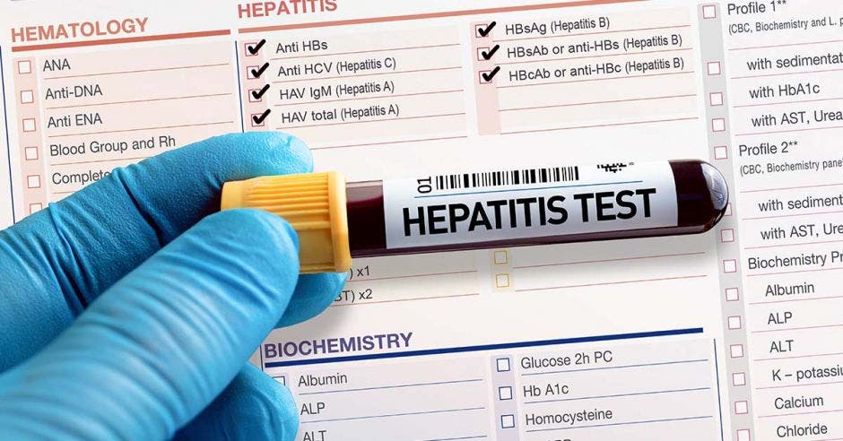 Hepatitis Test