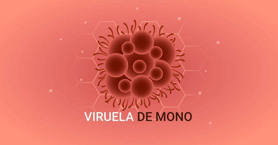 Viruela del mono