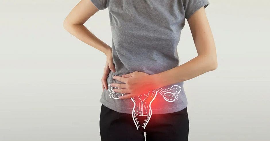 endometriosis, Caja, medicamento, mujeres