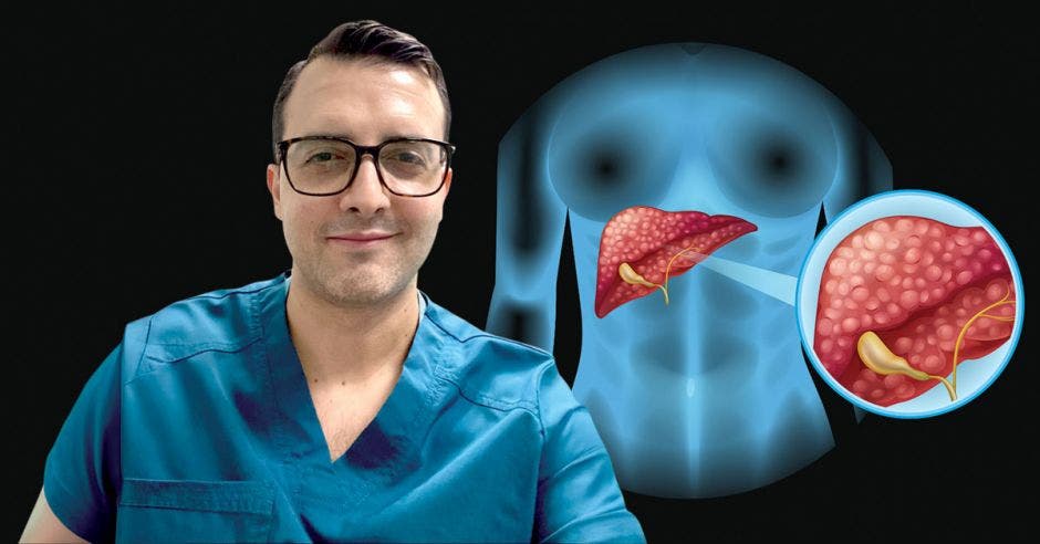 Esteban Ruiz, médico gastroenterólogo con una subespecialidad en enfermedades del hígado, del Hospital Metropolitano