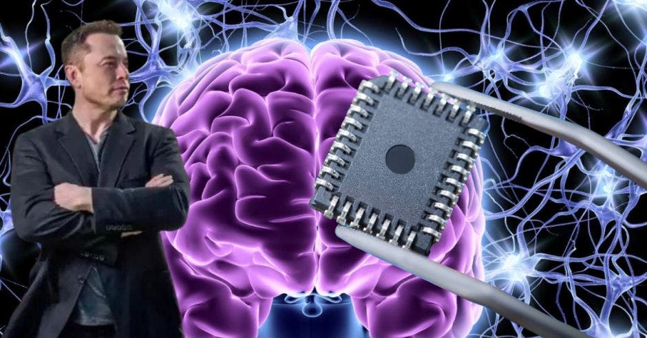 mover cursor computadora sin necesidad tocar dispositivo primeras habilidades persona le fue implantado cerebro microprocesador desarrollado firma neuralink magnate tecnológico elon musk
